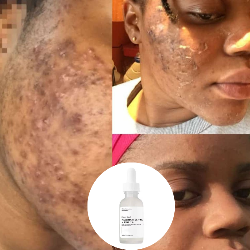 Ordinary Promo (1 Acheté - 1 offert)