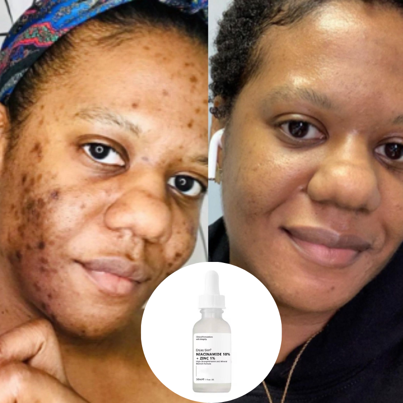 Ordinary Promo (1 Acheté - 1 offert)