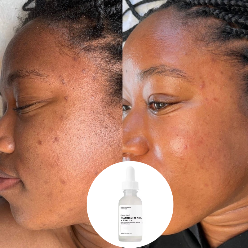 Ordinary Promo (1 Acheté - 1 offert)